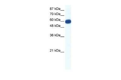 Western Blot: VMAT1/SLC18A1 Antibody [NBP2-88578] - WB Suggested Anti-SLC18A1 Antibody Titration: 0.2-1 ug/ml. ELISA Titer: 1:312500. Positive Control: Jurkat cell lysate