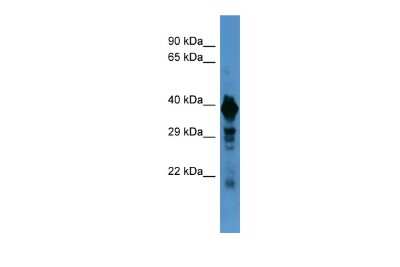 Western Blot: VMAT1/SLC18A1 Antibody [NBP2-88579] - Host: Rabbit. Target Name: SLC18A1. Sample Type: Hela Whole Cell lysates. Antibody Dilution: 1.0ug/ml