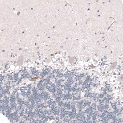 Immunohistochemistry-Paraffin: VMAT2 Antibody (CL12531) [NBP3-18570] - Staining of human cerebellum shows no positivity in Purkinje cells as expected.