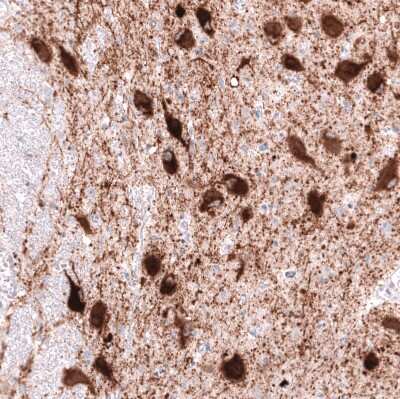 Immunohistochemistry-Paraffin: VMAT2 Antibody (CL13157) [NBP3-18556] - Staining of human dorsal raphe nucleus shows strong cytoplasmic positivity in neurons.