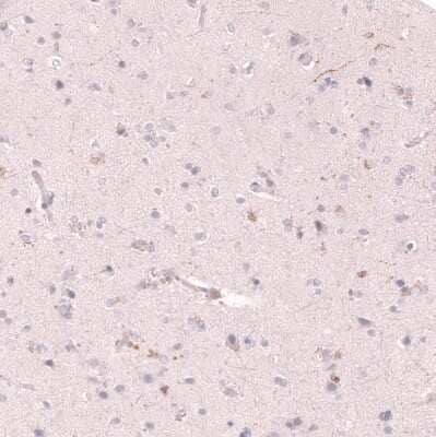 Immunohistochemistry-Paraffin: VMAT2 Antibody (CL13157) [NBP3-18556] - Staining of human cerebral cortex shows positivity in single neural fibers, and no staining in neurons as expected.