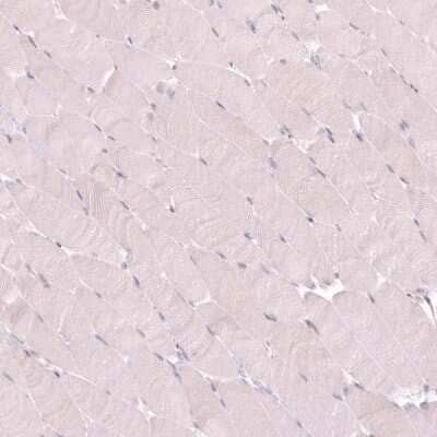 Immunohistochemistry-Paraffin: VMAT2 Antibody (CL13157) [NBP3-18556] - Staining of human skeletal muscle shows no positivity in myocytes as expected.