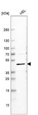 Western Blot: VMAT2 Antibody (CL13157) [NBP3-18556] - Analysis in human cell line HEL.