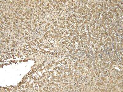 Immunohistochemistry: VMAT2 Antibody [NB100-1479] - (6ug/ml) staining of paraffin embedded Human Adrenal Gland. Heat induced antigen retrieval with citrate buffer pH 6, HRP-staining.