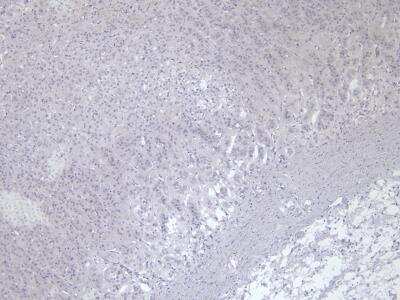 Immunohistochemistry: VMAT2 Antibody [NB100-1479] - Negative Control showing staining of paraffin embedded Human Adrenal Gland, with no primary antibody.