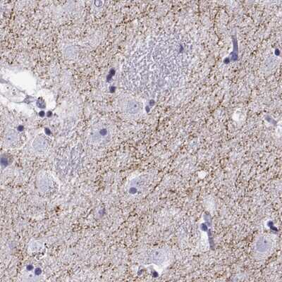 Immunohistochemistry: VMAT2 Antibody [NBP2-68952] - Immunohistochemical staining of human caudate shows strong positivity in neuronal projections.