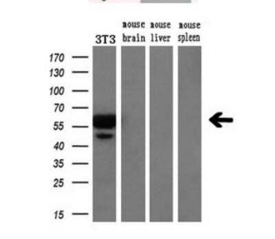 Western Blot: VMAT2 Antibody (OTI9E11) - Azide and BSA Free [NBP2-74850] - Analysis of extracts (10ug) from a mouse cell line and 3 different mouse tissues by using anti SLC18A2 monoclonal antibody.(1:200).
