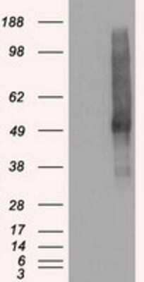 Western Blot: VMAT2 Antibody (OTI9E11) - Azide and BSA Free [NBP2-74850] - HEK293T cells were transfected with the pCMV6-ENTRY control (Left lane) or pCMV6-ENTRY VMAT2 (Right lane) cDNA for 48 hrs and lysed. Equivalent amounts of cell lysates (5 ug per lane) were separated by SDS-PAGE and immunoblotted with anti-VMAT2.