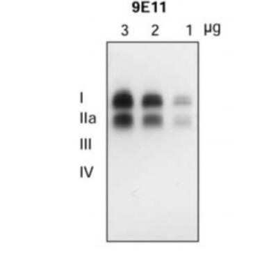 Western Blot: VMAT2 Antibody (OTI9E11) - Azide and BSA Free [NBP2-74850] - VMAT2 protein level by using anti-VMAT2 (9E11) antibody in the striatum of autopsied human brain.