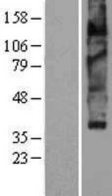 Western Blot: VMAT2 Overexpression Lysate (Adult Normal) [NBP2-04241] Left-Empty vector transfected control cell lysate (HEK293 cell lysate); Right -Over-expression Lysate for VMAT2.