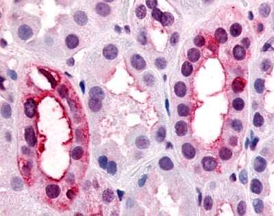Immunohistochemistry-Paraffin: VN1R1 Antibody [NLS3460] - Analysis of anti-VN1R1 antibody with human kidney, renal tubules at 7 ug/ml.