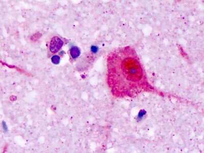 Immunohistochemistry-Paraffin: VN1R1 Antibody [NLS3461] - Analysis of anti-V1RL1 / VN1R1 antibody with human brain, cortex, neurons at dilution 7 ug/ml.
