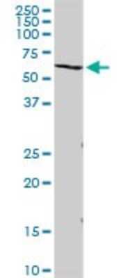 Western Blot: VNN2 Antibody [H00008875-B01P] - Analysis of VNN2 expression in HeLa.