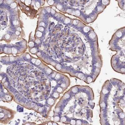 Immunohistochemistry-Paraffin: VP26B Antibody [NBP1-92575] - Staining of human small intestine shows strong membranous positivity in glandular cells.