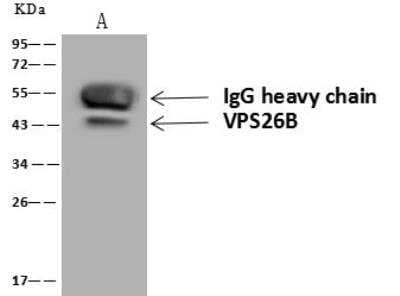 Immunoprecipitation: VP26B Antibody [NBP3-12624] - Lane A:0.5 mg Mouse brain tissue lysate Whole Cell Lysate4 uL anti-VPS26B rabbit polyclonal antibody and 60 ug of Immunomagnetic beads Protein A/G.Primary antibody:Anti-VPS26B rabbit polyclonal antibody,at 1:100 dilution Secondary antibody:Goat Anti-Rabbit IgG (H+L)/HRP at 1/10000 dilutionDeveloped using the ECL technique.Performed under reducing conditions.Predicted band size: 39 kDaObserved band size :43 kDa