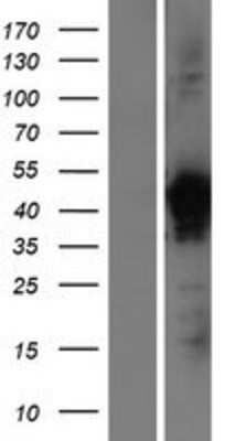 Western Blot VP26B Overexpression Lysate