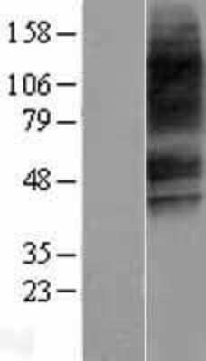 Western Blot: VPAC2 Overexpression Lysate (Adult Normal) [NBP2-04248] Left-Empty vector transfected control cell lysate (HEK293 cell lysate); Right -Over-expression Lysate for VPAC2.