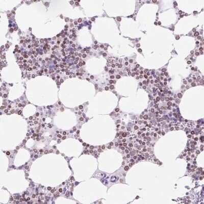 Immunohistochemistry VPREB1 Antibody - BSA Free