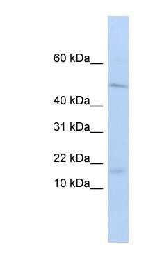 Western Blot: VPREB1 Antibody [NBP1-70741] - Titration: 0.2-1 ug/ml, Positive Control: HepG2 cell lysate.