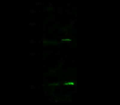 Western Blot: VPREB1 Antibody [NBP2-99054] - Anti-VPREB1 rabbit polyclonal antibody at 1:500 dilution. Lane A: HepG2 Whole Cell Lysate. Lane B: THP1 Whole Cell Lysate. Lysates/proteins at 30 ug per lane. Secondary Goat Anti- Rabbit  IgG H&L (Dylight 800)  at 1/10000 dilution. Developed using the Odyssey technique. Performed under reducing conditions. Predicted band size: 17 kDa. Observed band size: 17 kDa (We are unsure as to the identity of these extra bands).