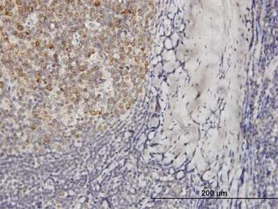 Immunohistochemistry-Paraffin: VPREB3 Antibody [H00029802-B01P] - Analysis of purified antibody to VPREB3 on formalin-fixed paraffin-embedded human tonsil. (antibody concentration 3 ug/ml)