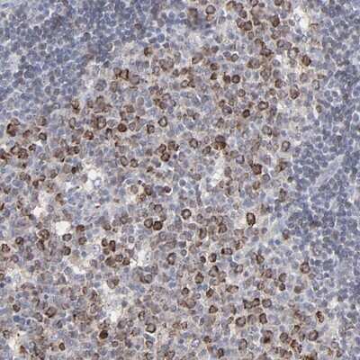 Immunohistochemistry-Paraffin: VPREB3 Antibody [NBP1-89347] - Staining of human lymph node shows strong cytoplasmic positivity in reaction center cells.