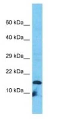 Western Blot: VPREB3 Antibody [NBP3-09504] - Western blot analysis of VPREB3 in HT1080 Whole Cell lysates. Antibody dilution at 1.0ug/ml