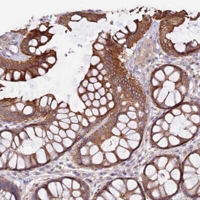 Immunohistochemistry-Paraffin: VPS11 Antibody [NBP2-47583] - Staining of human rectum shows strong cytoplasmic and membranous positivity in glandular cells.