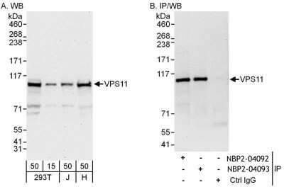 Immunoprecipitation: VPS11 Antibody [NBP2-04093] - Samples: Whole cell lysate from 293T (15 and 50 ug for WB; 1 mg for IP, 20% of IP loaded), Jurkat (J; 50 ug) and HeLa (H; 50 ug) cells. Antibodies: Affinity purified rabbit anti-VPS11 antibody NBP2-04092 used for WB at 0.1 ug/ml (A) and 1 ug/ml (B) and used for IP at 6 ug/mg lysate. VPS11 was also immunoprecipitated by rabbit anti-VPS11 antibody NBP2-04093, which recognizes a downstream epitope. Detection: Chemiluminescence with exposure times of 30 seconds (A) and 10 seconds (B).