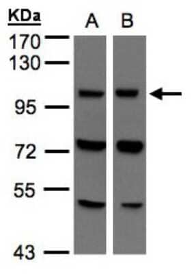 Western Blot: VPS11 Antibody [NBP1-31054] - Sample(30 ug of whole cell lysate)A:293TB:Hep G2 7. 5% SDS PAGE, antibody diluted at 1:500.