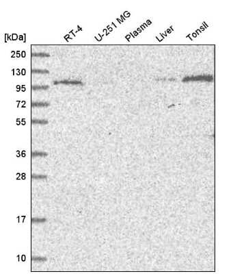 Western Blot: VPS11 Antibody [NBP2-47583] - Analysis in human cell line RT-4, human cell line U-251 MG, human plasma, human liver tissue and human tonsil tissue.