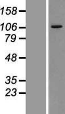 Western Blot: VPS11 Overexpression Lysate (Adult Normal) [NBL1-17736] Left-Empty vector transfected control cell lysate (HEK293 cell lysate); Right -Over-expression Lysate for VPS11.