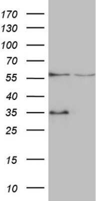 Western Blot: VPS13B Antibody (OTI6F6) - Azide and BSA Free [NBP2-74853] - Analysis of HEK293T cells were transfected with the pCMV6-ENTRY control (Left lane) or pCMV6-ENTRY VPS13B.