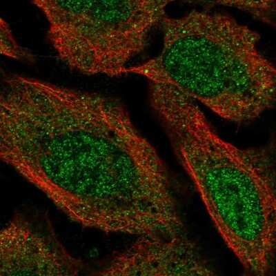 Immunocytochemistry/Immunofluorescence: VPS13D Antibody [NBP2-58336] - Staining of human cell line U-2 OS shows localization to nucleoplasm & cytosol. Antibody staining is shown in green.