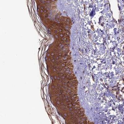 Immunohistochemistry: VPS16 Antibody [NBP2-48785] - Staining of human skin shows strong cytoplasmic positivity in epidermal cells.