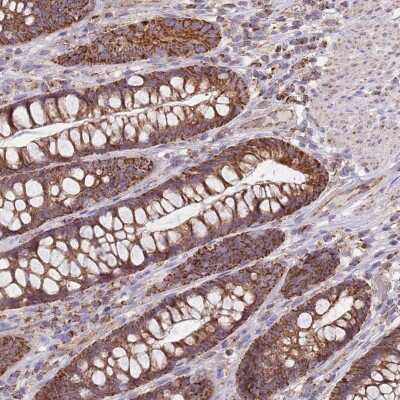 Immunohistochemistry: VPS16 Antibody [NBP2-48912] - Staining of human rectum shows strong granular cytoplasmic positivity in glandular cells.