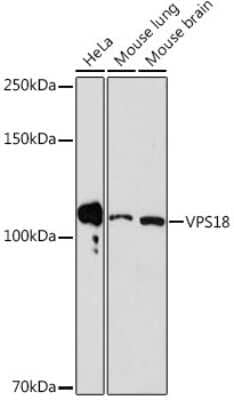 Western Blot: VPS18 Antibody (1W8T9) [NBP3-15542] - Western blot analysis of extracts of various cell lines, using VPS18 Rabbit mAb (NBP3-15542) at 1:1000 dilution. Secondary antibody: HRP Goat Anti-Rabbit IgG (H+L) at 1:10000 dilution. Lysates/proteins: 25ug per lane. Blocking buffer: 3% nonfat dry milk in TBST. Detection: ECL Basic Kit. Exposure time: 180s.