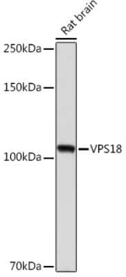 Western Blot: VPS18 Antibody (1W8T9) [NBP3-15542] - Western blot analysis of extracts of Rat brain, using VPS18 Rabbit mAb (NBP3-15542) at 1:1000 dilution. Secondary antibody: HRP Goat Anti-Rabbit IgG (H+L) at 1:10000 dilution. Lysates/proteins: 25ug per lane. Blocking buffer: 3% nonfat dry milk in TBST. Detection: ECL Enhanced Kit. Exposure time: 180s.