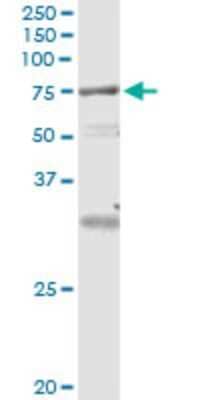 Immunoprecipitation: VPS18 Antibody (4E9) [H00057617-M04] - Analysis of VPS18 transfected lysate using anti-VPS18 monoclonal antibody and Protein A Magnetic Bead, and immunoblotted with VPS18 rabbit polyclonal antibody.