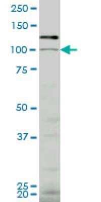 Western Blot: VPS18 Antibody (4E9) [H00057617-M04] - VPS18 monoclonal antibody (M04), clone 4E9. Western Blot analysis of VPS18 expression in K-562 ( Cat # L009V1 ).