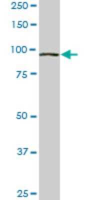 Western Blot: VPS18 Antibody (4F8) [H00057617-M01] - VPS18 monoclonal antibody (M01), clone 4F8. Analysis of VPS18 expression in Raw 264.7.