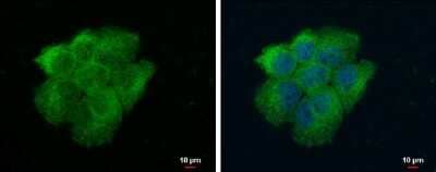 Immunocytochemistry/Immunofluorescence: VPS18 Antibody [NBP3-12906] - VPS18 antibody detects VPS18 protein at cytoplasm by immunofluorescent analysis. Sample: A431 cells were fixed in 4% paraformaldehyde at RT for 15 min. Green: VPS18 protein stained by VPS18 antibody (NBP3-12906) diluted at 1:1000. Blue: Hoechst 33342 staining. Scale bar = 10 um.