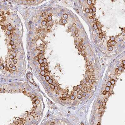 Immunohistochemistry-Paraffin: VPS18 Antibody [NBP1-82906] - Staining of human testis shows strong cytoplasmic positivity in cells of seminiferus ducts.