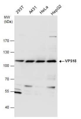 Western Blot: VPS18 Antibody [NBP3-12906] - VPS18 antibody detects VPS18 protein by western blot analysis. Various whole cell extracts (30 ug) were separated by 7.5% SDS-PAGE, and the membrane was blotted with VPS18 antibody (NBP3-12906) diluted at a dilution of 1:1000.