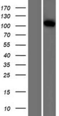 Western Blot: VPS18 Overexpression Lysate (Adult Normal) [NBL1-17737] Left-Empty vector transfected control cell lysate (HEK293 cell lysate); Right -Over-expression Lysate for VPS18.