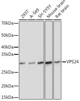 Western Blot: VPS24 Antibody (1L10B7) [NBP3-16902] - Western blot analysis of extracts of various cell lines, using VPS24 Rabbit mAb (NBP3-16902) at 1:1000 dilution. Secondary antibody: HRP Goat Anti-Rabbit IgG (H+L) at 1:10000 dilution. Lysates/proteins: 25ug per lane. Blocking buffer: 3% nonfat dry milk in TBST. Detection: ECL Basic Kit. Exposure time: 5s.