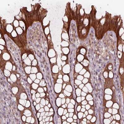 Immunohistochemistry-Paraffin: VPS24 Antibody [NBP2-68954] - Staining of human colon shows cytoplasmic positivity in glandular cells.