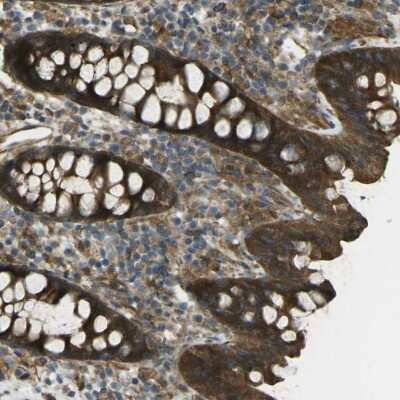 Immunohistochemistry-Paraffin: VPS24 Antibody [NBP1-89391] - Staining of human colon shows strong cytoplasmic positivity in glandular cells.