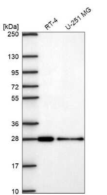 Western Blot VPS24 Antibody - BSA Free