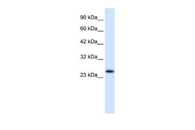 Western Blot: VPS24 Antibody [NBP2-88580] - WB Suggested Anti-VPS24 Antibody Titration: 0.2-1 ug/ml. ELISA Titer: 1:12500. Positive Control: HepG2 cell lysate